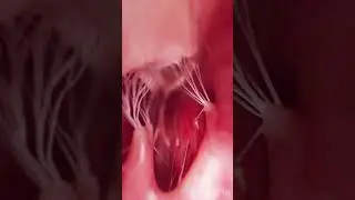 Dive Into the Heart: Discover the Chordae Tendineae