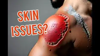 are people's skin rotting?, skin patches , skin lesions,  skin tags everywhere,  Eczema inflammatory