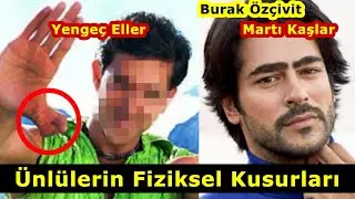 Ünlülerin Fiziksel Kusurları - Ünlülerin Estetiksiz Halleri