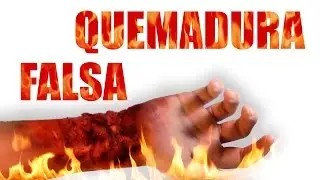 Como Hacer una Quemadura Falsa