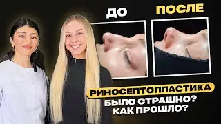 3. VLOG | Откровенно, все что вы хотели знать!