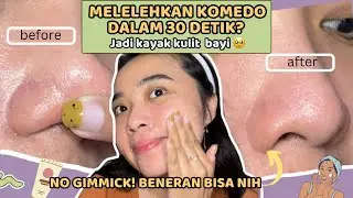 30 DETIK KOMEDO RONTOK! KULIT AUTO HALUS DAN CERAH👌~ HASIL EXFO GEL CLEORA TERBARU!