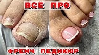 ПЕДИКЮР 🦶 Ногти сухарики 🦶 Френч на ногах 😍 Идеальные камуфляжи