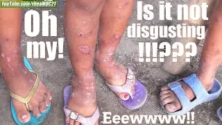 The Feet of These Filipino Children are not Disgusting? Giving Help to Filipinos in the Philippines