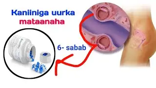 Kaniiniga uurka mataanaha ee Clomiphene citrate 6- sheey oo qasab tahay inaa ka ogaato ❤️✅👍