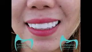 latest Snap On Smile!!