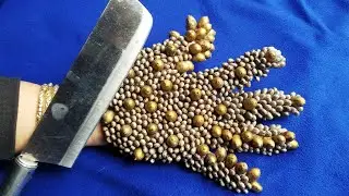 [Remove ticks] How to remove ticks from human skin 