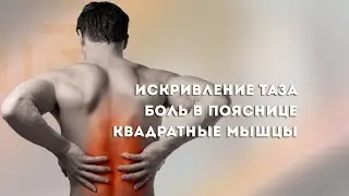 Искривление таза. Боль в пояснице. Квадратные мышцы