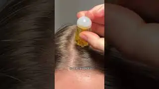 Гаджет для роста волос 👍