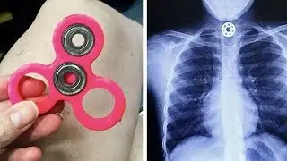 6 Juguetes populares que pueden hacerle daño