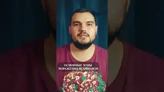 ОСНОВНЫЕ ЗОНЫ ПОРАЖЕНИЯ ПСОРИАЗОМ #PSORIK
