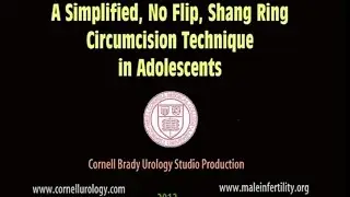 A Simplified, No Flip, Shang Ring Circumcision Technique in Adolescents