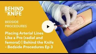 Placing Arterial Lines Like a Pro (radial and femoral) |  Behind the Knife - Bedside Procedures Ep 3