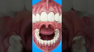 How Tonsil Stones Are Formed #short #tonsilstones - creativelearning3d