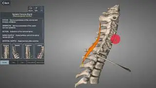 Musculus spelnius cervicis - nekspalkspier
