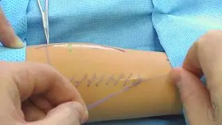 Continuous blanket suture making technique / Over-and-over continuos suture