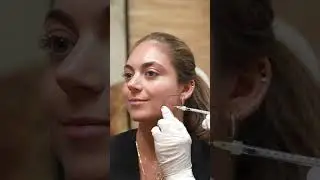 Masseter Botox