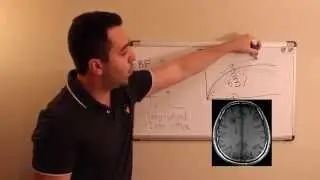 T1 weighted MRI