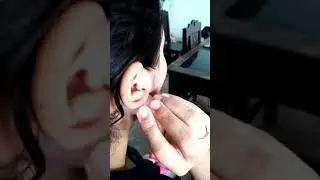 TÍPS para ARETES tips casero