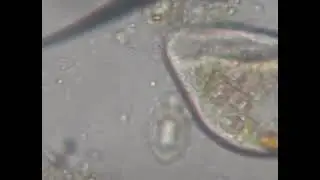 🔬Trofozoíto de Balantidium coli en muestra de heces | Parasitología