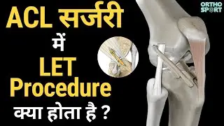 ACL Surgery मे LET Procedure क्या होता है ? Lateral Extra-Articular Tenodesis, Anterolateral Complex