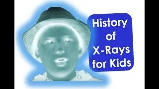 The History of X-Rays For Kids