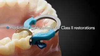 Palodent_technique.wmv