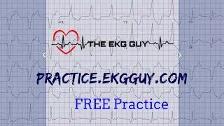 ECG Practice #2 | The EKG Guy - practice.ekgguy.com