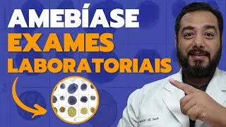 Quais exames laboratoriais podem detectar a Entamoeba histolytica (amebíase)? | Parasitologia