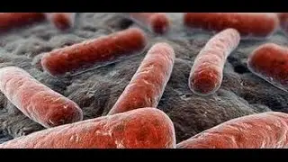 ✔ ASESINOS MICROSCÓPICOS TUBERCULOSIS Documentales Español