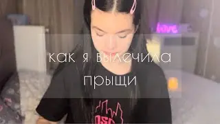 как я вылечила прыщи ч.2 | треш-дерматолог