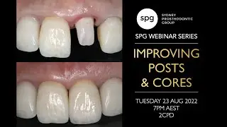 SPG Webinar: Improving Posts & Cores