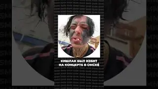Это нормально? 