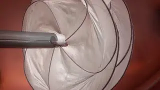 GORE® CARDIOFORM Septal Occluder PFO Animation