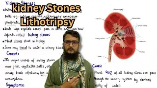 kidney stones | disorders of kidney | lithotripsy | class 10