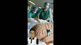 EL MITO DE QUE SOLO USAMOS EL 10% DEL CEREBRO