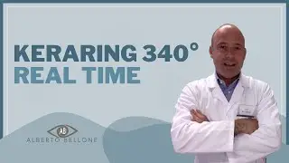 Keraring 340° REAL TIME: Implanted a ring for nipple keratoconus