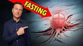 Pharmacist Ben Fuchs Reviews Fasting/Cancer Risk Study