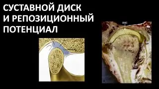 ДИСФУНКЦИЯ ВНЧС РЕПОЗИЦИОННЫЙ ПОТЕНЦИАЛ