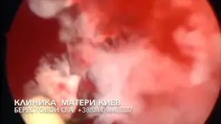 НА ГРАНИ ЖИЗНИ И СМЕРТИ! Счет на дни и часы.