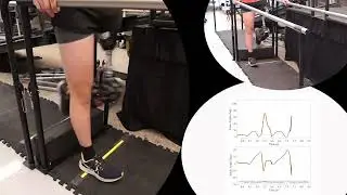 Automatic Stub Avoidance for a Powered Prosthetic Leg over Stairs and Obstacles