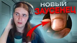 КУНЯКИН ПРО СВОЕ ЗДОРОВЬЕ (сколиоз, зависимости и тд)