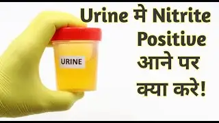 urine nitrite test | nitrite positive in urine in hindi