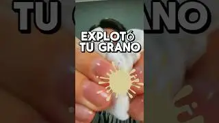 EXPLOTÓ TU GRANITO #asmr #shorts #asmrvideo #comedia