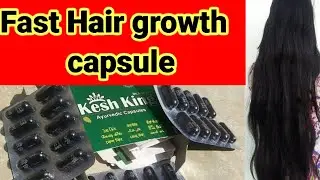Faster hair growth capsule | Kesh king capsule review | best hair fall control medicine | 