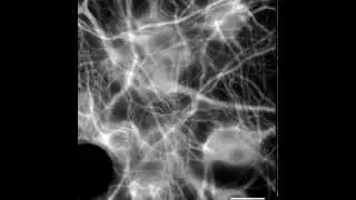 Brain extracellular matrix retains connectivity in neuronal networks