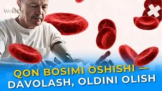 Qon bosimi oshishi — sabablari, belgilari, gipertoniyani davolash, oldini olish