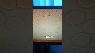 Кандидоз на микроскопе #кандидоз #микроскоп #кровь