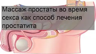Массаж простаты во время секса как способ лечения простатита