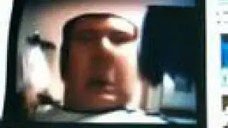 Numa Numa Deformity
